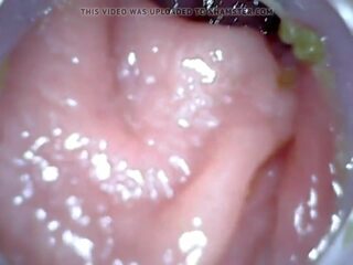 Anal Endoscope Part 1, Free Enema Punishment HD dirty clip 04